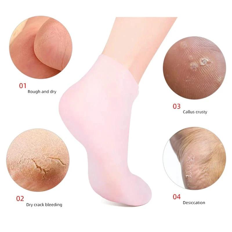 Silicone Moisturizing Spa Gel Heel Socks for Cracked Heels Silicone socks Corn & Callus Care Supplies