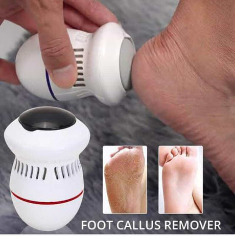 Waterproof Eclectric Rechargeable Foot Callus Remover | Smooth Feet Care Tool- Furaha Finds Kenya